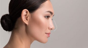 Perbedaan Filler Hidung dan Tanam Benang
