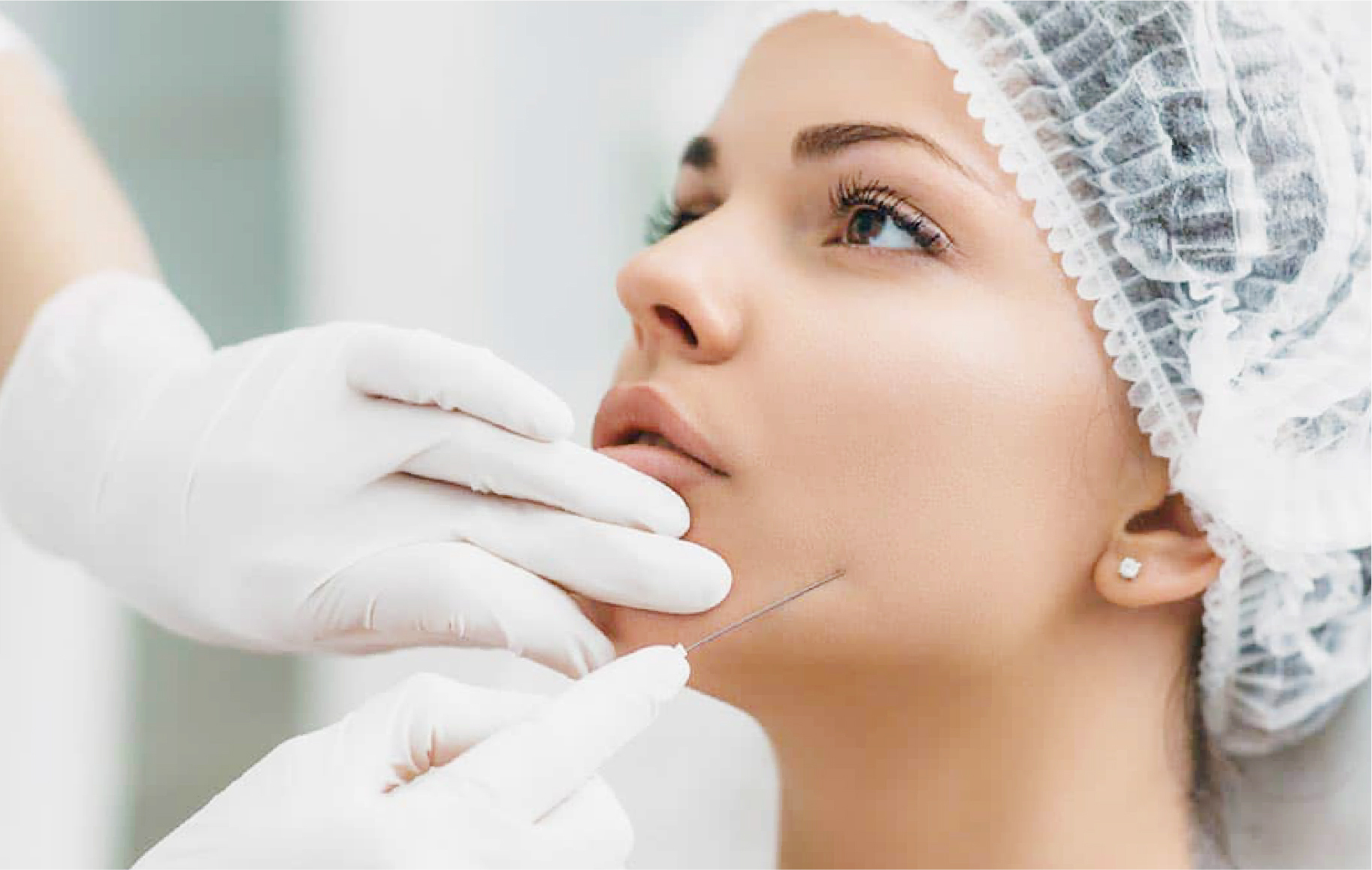 Prosedur botox rahang