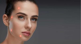 Pico laser untuk wajah – ini 4 manfaatnya