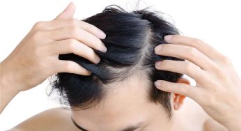 Cara Menebalkan Rambut Pria Terbaik