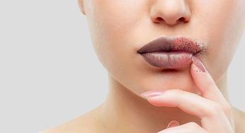 Mencerahkan Bibir Hitam – Tips Perawatan yang Efektif
