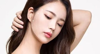 Tanam benang wajah – Solusi untuk Kulit Kendur